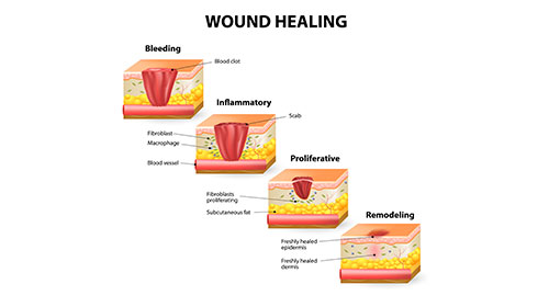 Wound Management  Overview